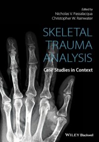 cover of the book Skeletal trauma analysis: case studies in context