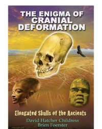 cover of the book The Enigma of Cranial Deformation