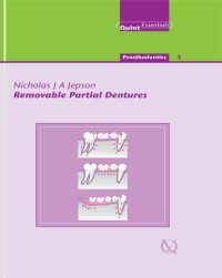 cover of the book Removable Partial Dentures