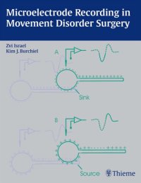 cover of the book Microelectrode recording in movement disorder surgery