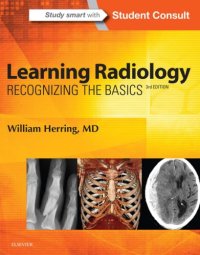 cover of the book Learning radiology: recognizing the basics