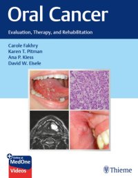 cover of the book Oral Cancer: Evaluation, Therapy, and Rehabilitation