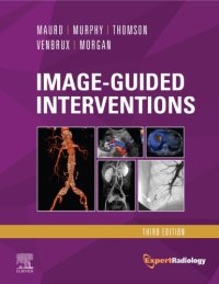 cover of the book Image-Guided Interventions (Expert Radiology Series)