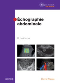 cover of the book Echographie abdominale