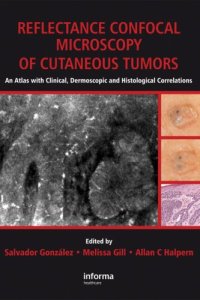 cover of the book Reflectance Confocal Microscopy of Cutaneous Tumors: An Atlas with Clinical, Dermoscopic and Histological Correlations