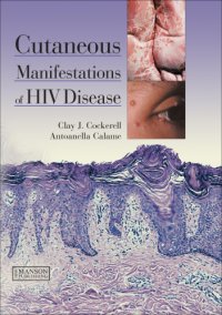 cover of the book Cutaneous Manifestations of HIV Disease