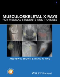 cover of the book Musculoskeletal X-rays for medical students and trainees