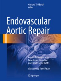 cover of the book Endovascular Aortic Repair