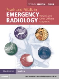 cover of the book Pearls and pitfalls in emergency radiology: variants and other difficult diagnoses