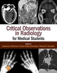 cover of the book Critical observations in radiology for medical students