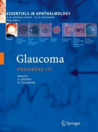 cover of the book Glaucoma