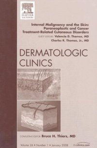 cover of the book Internal Malignancy and The Skin: Paraneoplastic and Cancer Treatment-Related Cutaneous Disorders, An Issue of Dermatologic Clinics