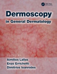 cover of the book Dermoscopy in general dermatology