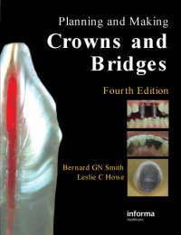 cover of the book Planning and making crowns and bridges