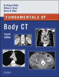 cover of the book Fundamentals of Body CT