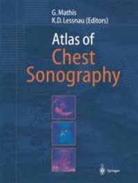 cover of the book Atlas of Chest Sonography