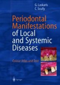 cover of the book Periodontal Manifestations of Local and Systemic Diseases: Colour Atlas and Text