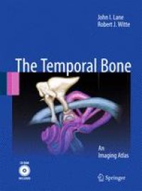 cover of the book The Temporal Bone: An Imaging Atlas