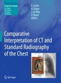 cover of the book Comparative Interpretation of CT and Standard Radiography of the Chest