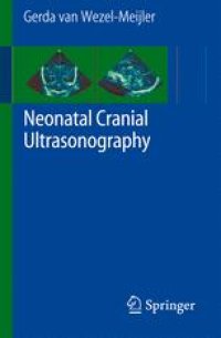 cover of the book Neonatal Cranial Ultrasonography