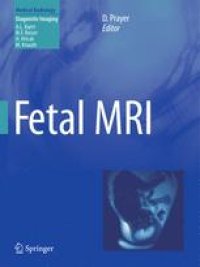 cover of the book Fetal MRI