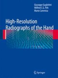 cover of the book High-Resolution Radiographs of the Hand