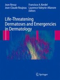 cover of the book Life-Threatening Dermatoses and Emergencies in Dermatology