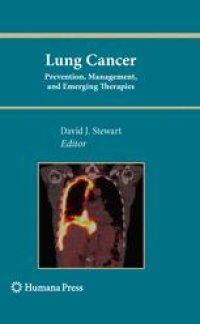 cover of the book Lung Cancer: Prevention, Management, and Emerging Therapies