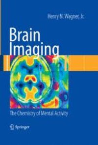 cover of the book Brain Imaging: The Chemistry of Mental Activity