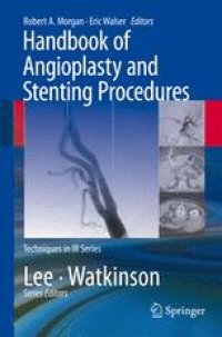 cover of the book Handbook of Angioplasty and Stenting Procedures