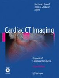 cover of the book Cardiac CT Imaging: Diagnosis of Cardiovascular Disease