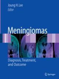 cover of the book Meningiomas