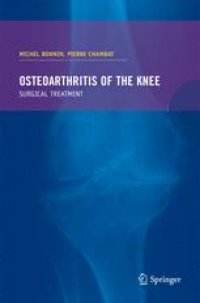 cover of the book Osteoarthritis of the knee