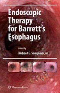 cover of the book Endoscopic Therapy for Barrett's Esophagus