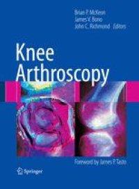 cover of the book Knee Arthroscopy