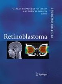 cover of the book Retinoblastoma