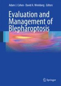 cover of the book Evaluation and Management of Blepharoptosis