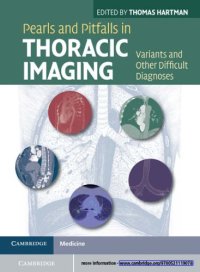 cover of the book Pearls and pitfalls in thoracic imaging: variants and other difficult diagnoses