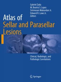 cover of the book Atlas of sellar and parasellar lesions: clinical, radiologic, and pathologic correlations