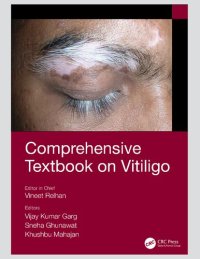 cover of the book Comprehensive Textbook on Vitiligo