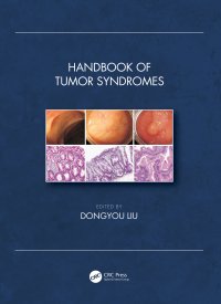 cover of the book Handbook of Tumor Syndromes