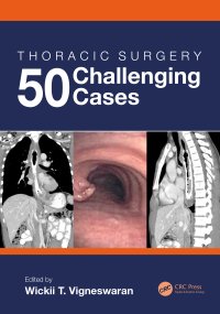 cover of the book Thoracic Surgery: 50 Challenging cases