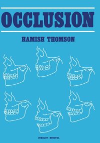 cover of the book Occlusion