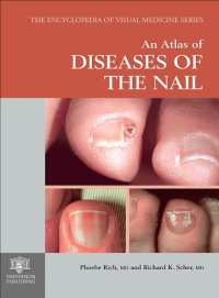 cover of the book An atlas of diseases of the nail