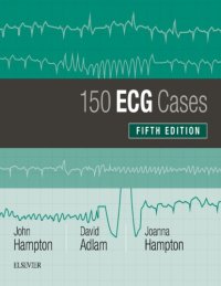 cover of the book 150 ECG Cases [CONVERTED PDF]