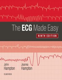 cover of the book The ECG Made Easy [CONVERTED PDF]