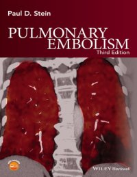 cover of the book Pulmonary Embolism