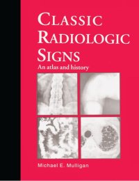 cover of the book Classic radiologic signs an atlas and history