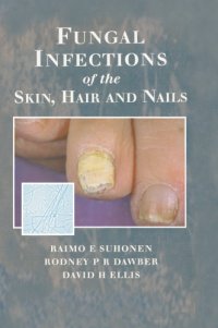 cover of the book Fungal Infections Of The Skin And Nails