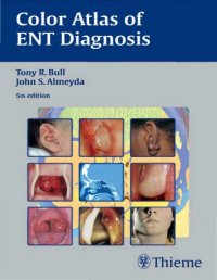 cover of the book Color Atlas of ENT Diagnosis